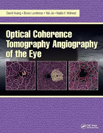 Optical Coherence Tomography Angiography of the Eye cover