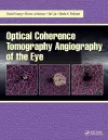 Optical Coherence Tomography Angiography of the Eye cover