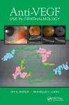 Anti-VEGF Use in Ophthalmology cover