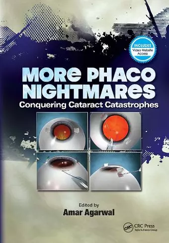 More Phaco Nightmares cover