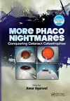 More Phaco Nightmares cover