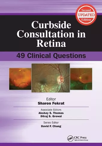 Curbside Consultation in Retina cover