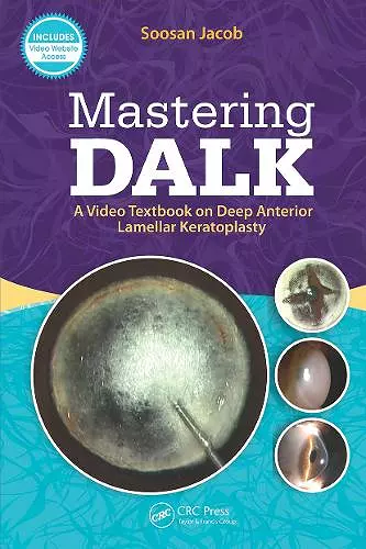 Mastering DALK cover