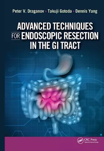 Advanced Techniques for Endoscopic Resection in the GI Tract cover