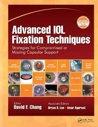 Advanced IOL Fixation Techniques cover