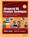 Advanced IOL Fixation Techniques cover