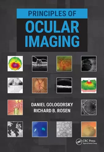 Principles of Ocular Imaging cover