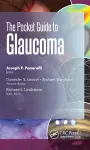 The Pocket Guide to Glaucoma cover