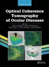 Optical Coherence Tomography of Ocular Diseases cover