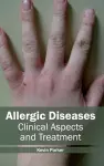 Allergic Diseases: Clinical Aspects and Treatment cover
