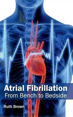 Atrial Fibrillation: From Bench to Bedside cover