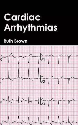 Cardiac Arrhythmias cover