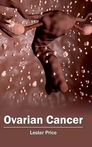 Ovarian Cancer cover