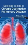 Selected Topics in Chronic Obstructive Pulmonary Disease cover