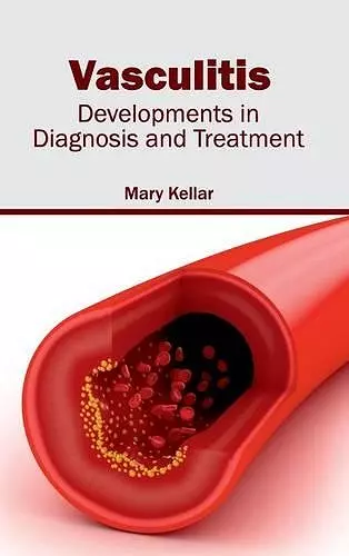 Vasculitis: Developments in Diagnosis and Treatment cover