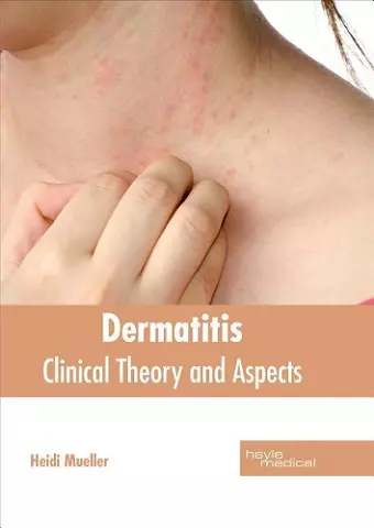 Dermatitis: Clinical Theory and Aspects cover