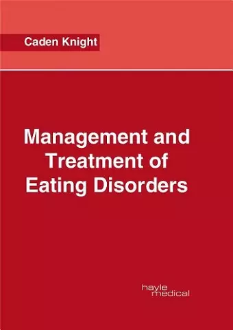 Management and Treatment of Eating Disorders cover