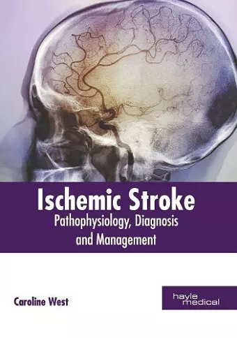 Ischemic Stroke: Pathophysiology, Diagnosis and Management cover