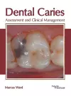 Dental Caries: Assessment and Clinical Management cover