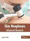 Skin Neoplasms: Advanced Research cover