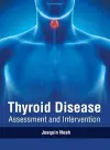 Thyroid Disease: Assessment and Intervention cover