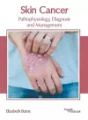 Skin Cancer: Pathophysiology, Diagnosis and Management cover