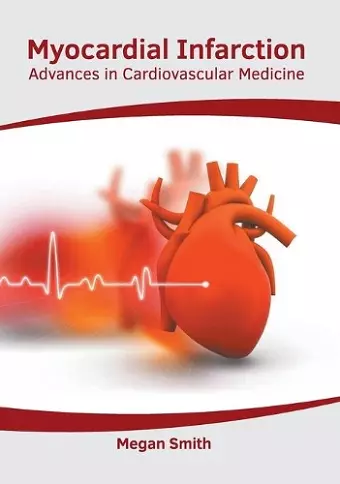 Myocardial Infarction: Advances in Cardiovascular Medicine cover