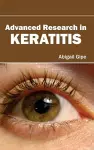 Advanced Research in Keratitis cover