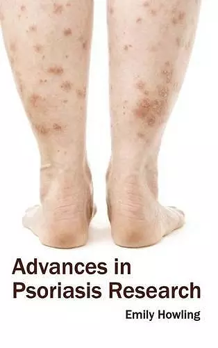 Advances in Psoriasis Research cover