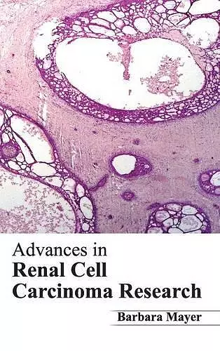 Advances in Renal Cell Carcinoma Research cover