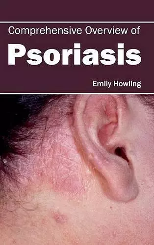 Comprehensive Overview of Psoriasis cover