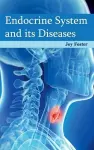 Endocrine System and Its Diseases cover