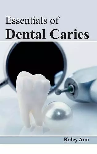 Essentials of Dental Caries cover