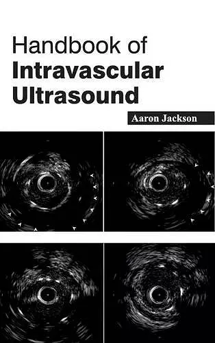 Handbook of Intravascular Ultrasound cover