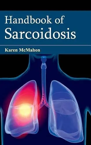 Handbook of Sarcoidosis cover
