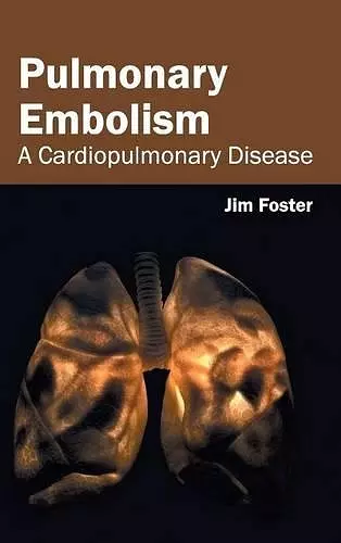 Pulmonary Embolism: A Cardiopulmonary Disease cover