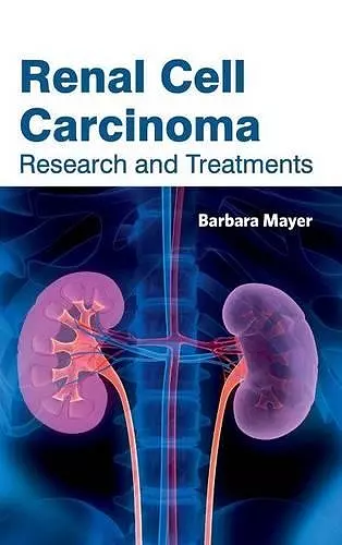 Renal Cell Carcinoma: Research and Treatments cover