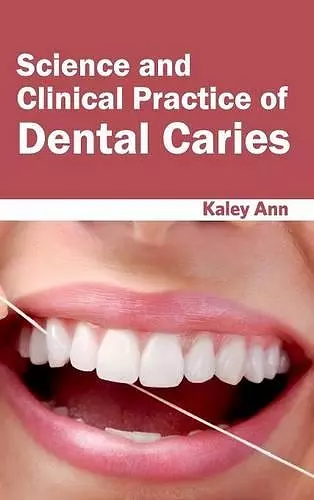 Science and Clinical Practice of Dental Caries cover