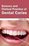 Science and Clinical Practice of Dental Caries cover