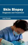 Skin Biopsy: Diagnosis and Treatment cover