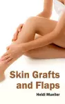 Skin Grafts and Flaps cover