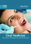 Oral Medicine: The Basis of Diagnosis and Treatment cover