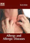 Allergy and Allergic Diseases cover