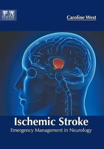 Ischemic Stroke: Emergency Management in Neurology cover