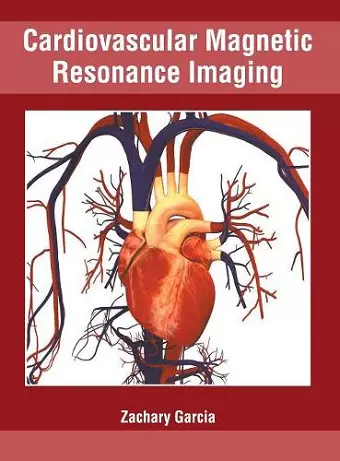 Cardiovascular Magnetic Resonance Imaging cover