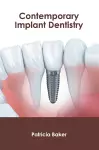 Contemporary Implant Dentistry cover