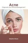 Acne: Diagnosis and Clinical Management cover