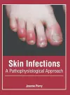 Skin Infections: A Pathophysiological Approach cover