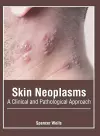 Skin Neoplasms: A Clinical and Pathological Approach cover