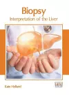 Biopsy: Interpretation of the Liver cover